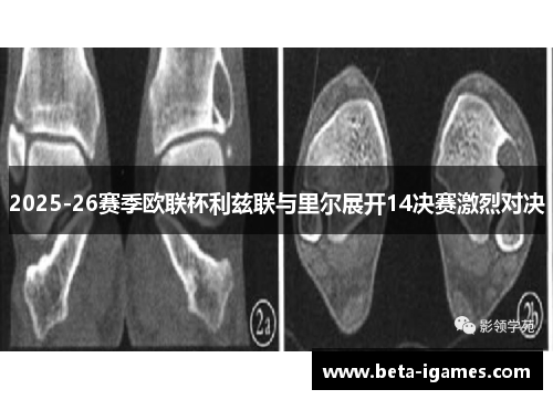 2025-26赛季欧联杯利兹联与里尔展开14决赛激烈对决